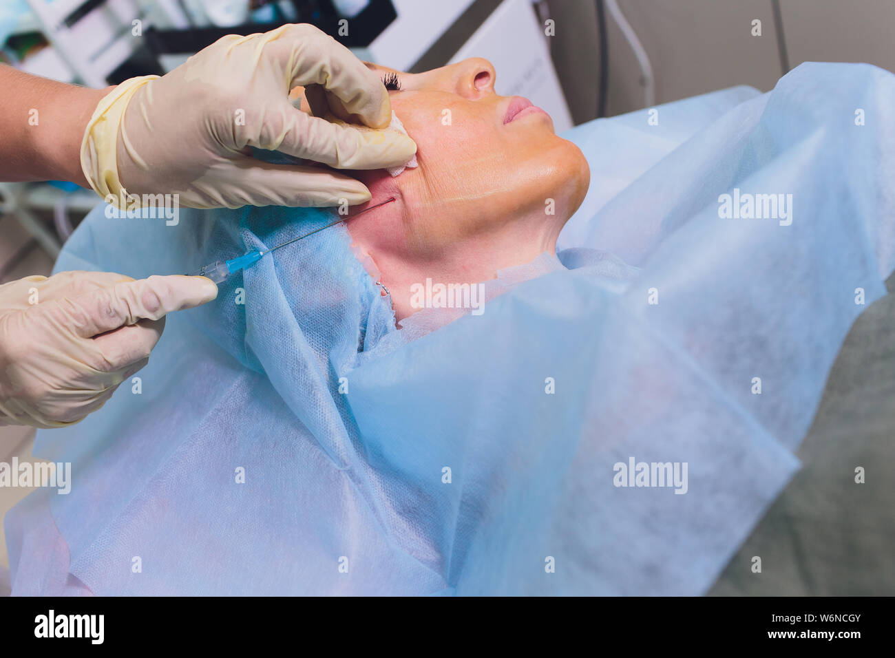 Aged woman doing mesothreads and Thread Lifting, Cosmetology. Cosmetic