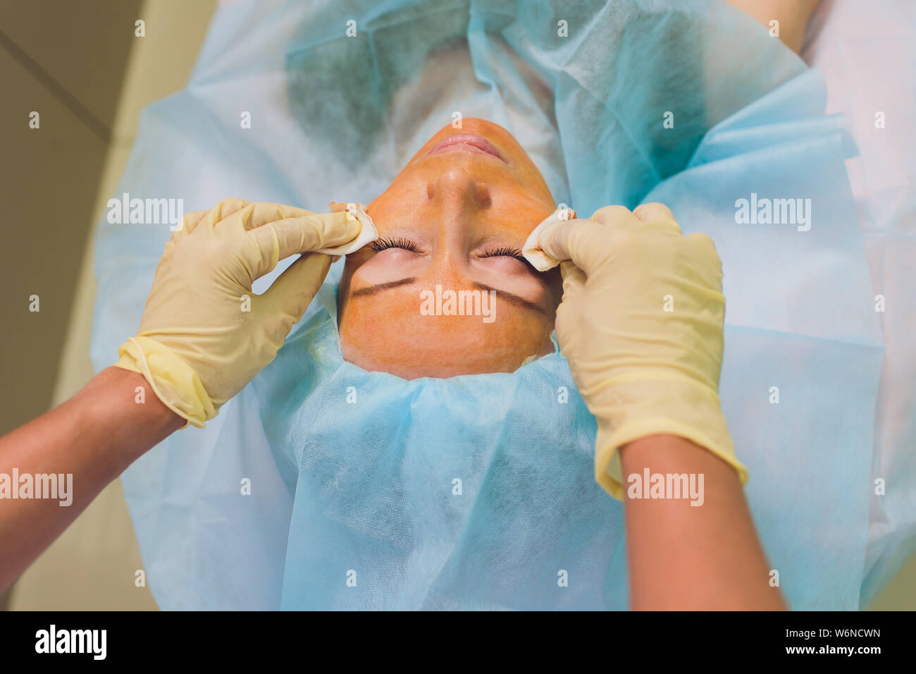 Aged woman doing mesothreads and Thread Lifting, Cosmetology. Cosmetic