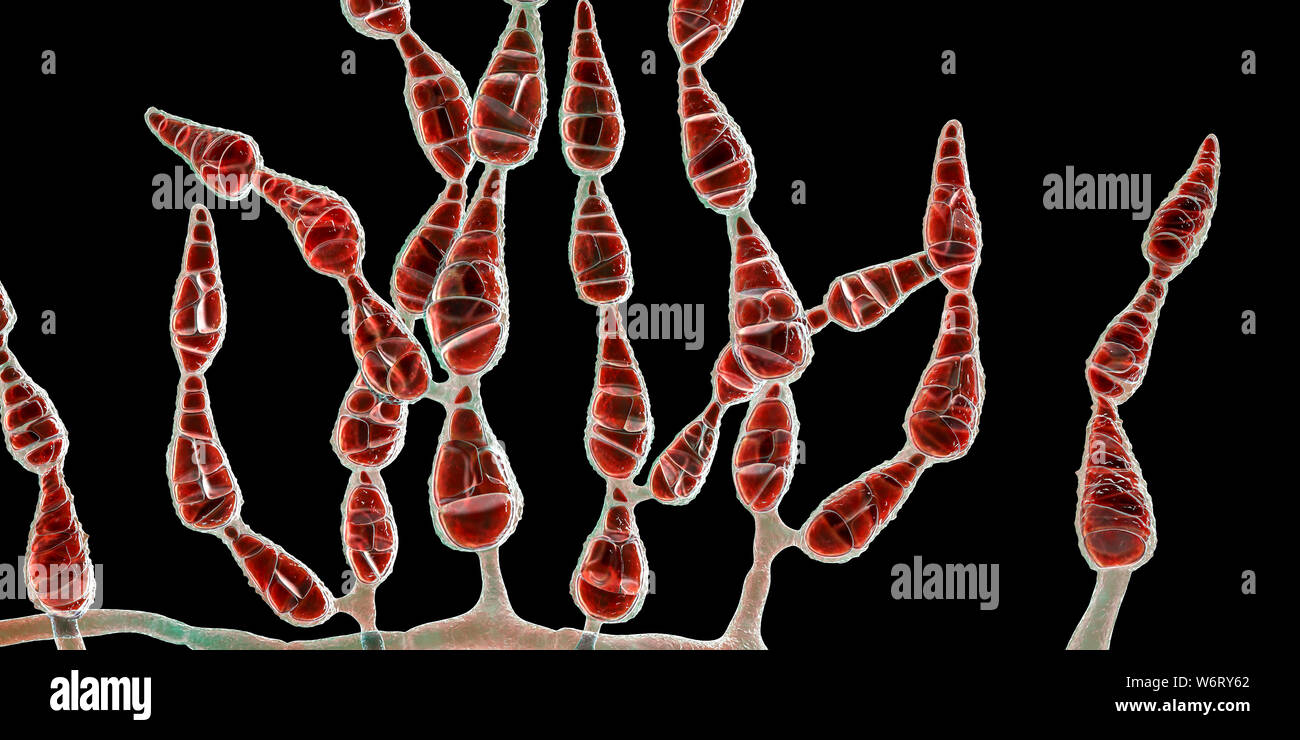 Filamentous allergenic fungus Alternaria alternata, computer illustration. Alternaria is a dematiaceous (phaeoid) fungus commonly isolated from plants Stock Photo