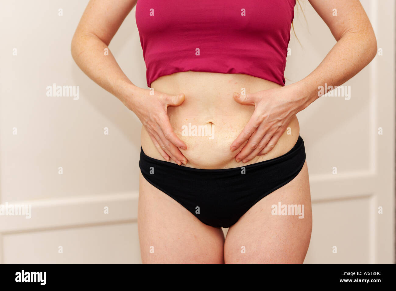 https://c8.alamy.com/comp/W6T8HC/women-show-off-the-belly-after-birth-stretch-marks-on-white-background-women-body-fat-belly-front-view-W6T8HC.jpg