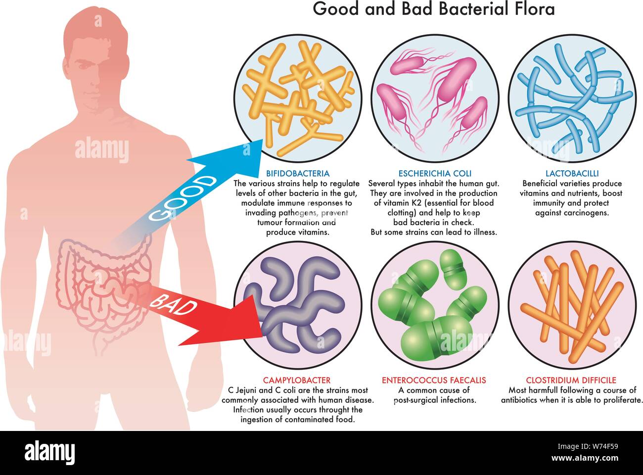 Medical illustration of the good and the bad bacterial flora Stock Vector