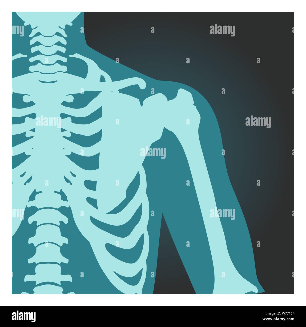 X-ray shot of shoulder, human body bones, radiography, rib cage, chest and arm, vector illustration. Stock Vector