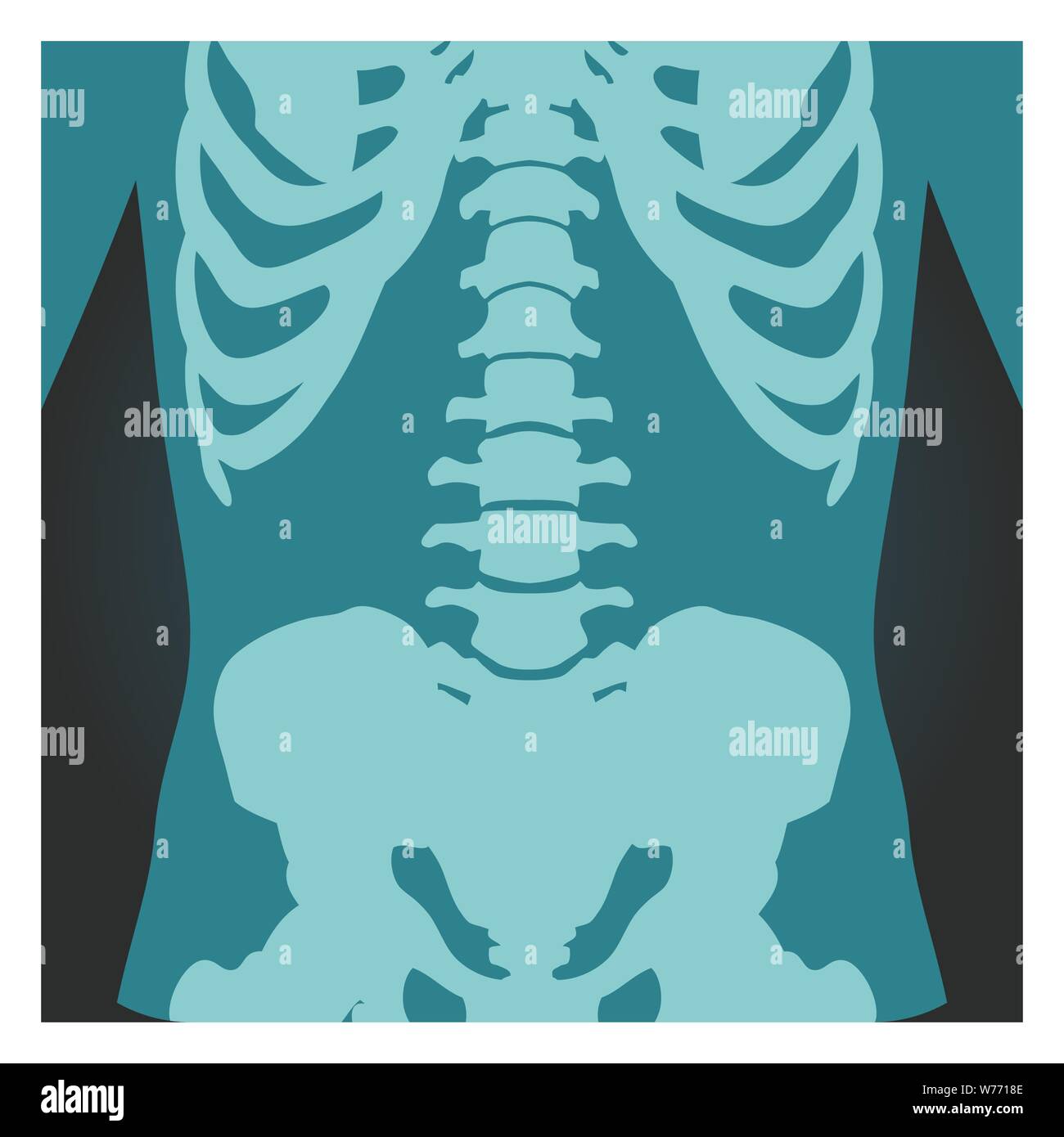 X-ray shot of spinal column, pelvis and rib cage, human body bones, radiography, vector illustration. Stock Vector