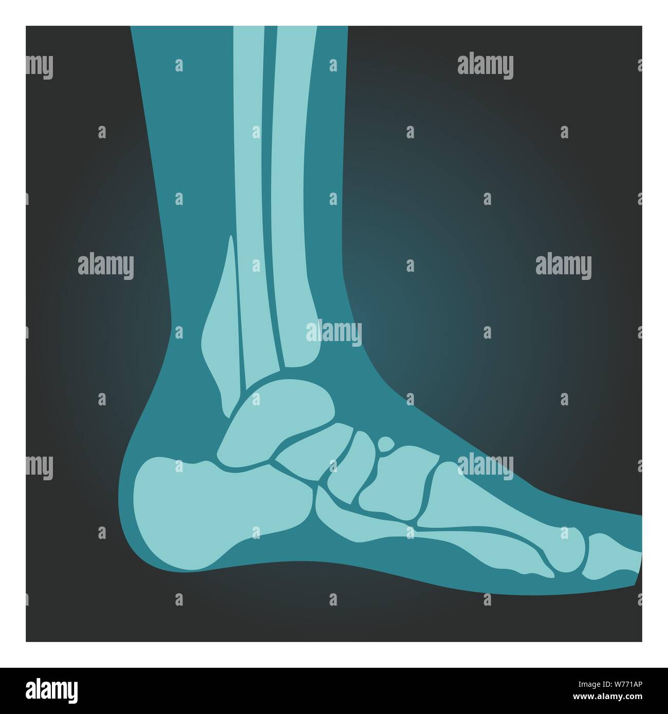 X-ray shot of foot side view, human body, bones, radiography, vector illustration. Stock Vector