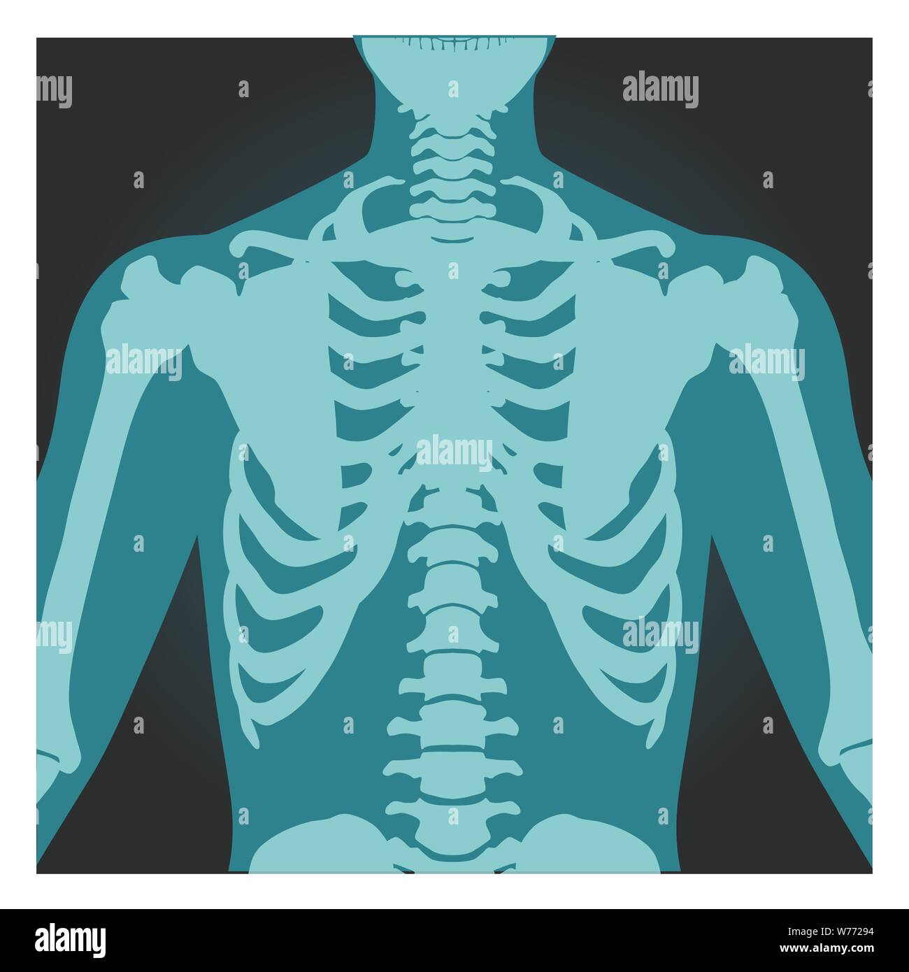 X-ray shot of shoulder, human body bones, radiography, rib cage, chest and arm, vector illustration. Stock Vector