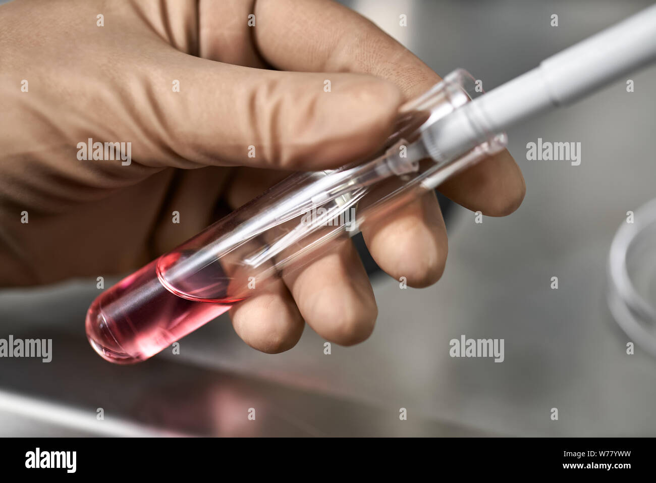 Doctor in brown latex gloves takes material from the test tube during ...