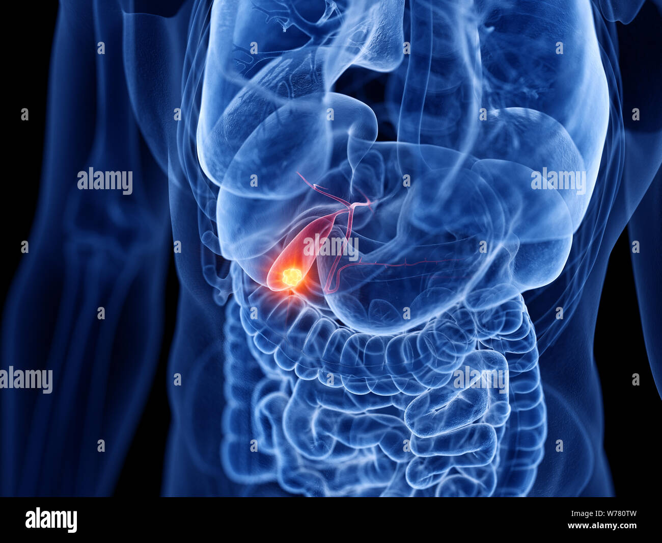 3d rendered medically accurate illustration of the gallbladder cancer Stock Photo Alamy