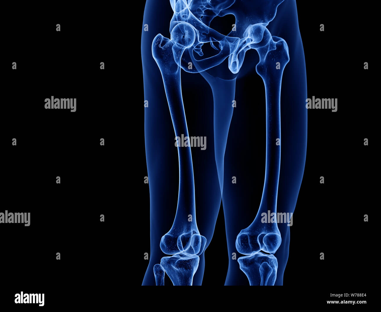 3d rendered medically accurate illustration of the upper leg bones
