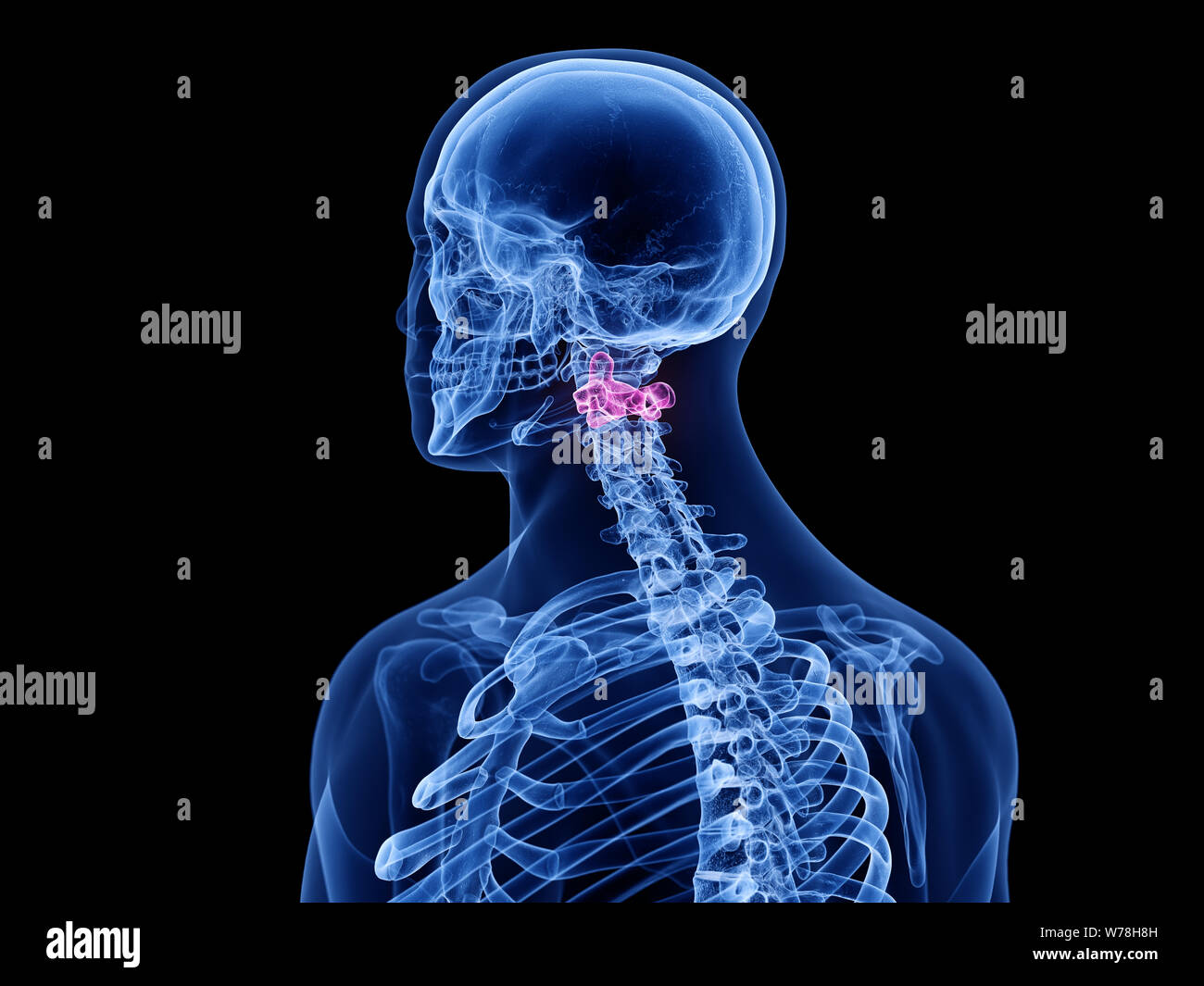 3d rendered medically accurate illustration of the axis vertebrae Stock Photo