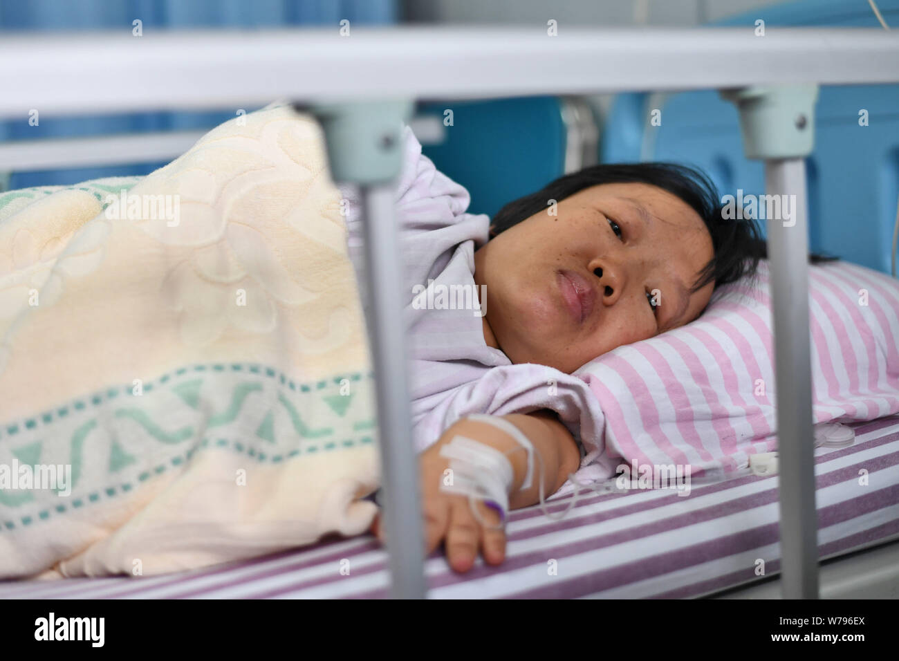 Chinese woman Wei Chunlan who is just a little over three feet tall with dwarfism is pictured before giving birth by Caesarean section at a hospital i Stock Photo