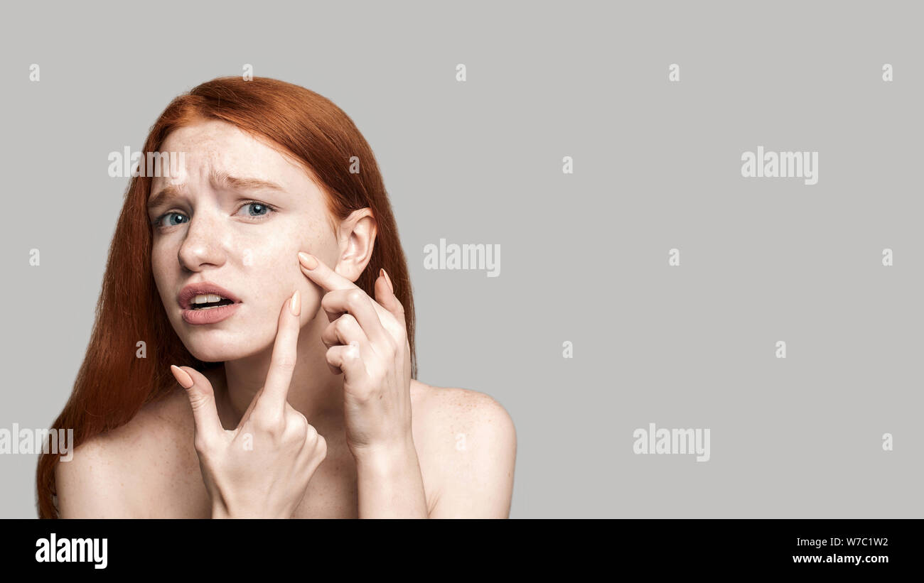 Studio shot of worried young redhead woman examining her face while standing against grey background. Acne. Skin care Stock Photo