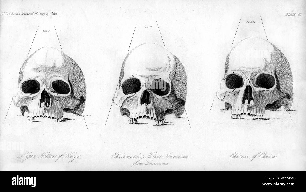 Three Types Of Human Skull 1848 Artist Unknown Stock Photo Alamy
