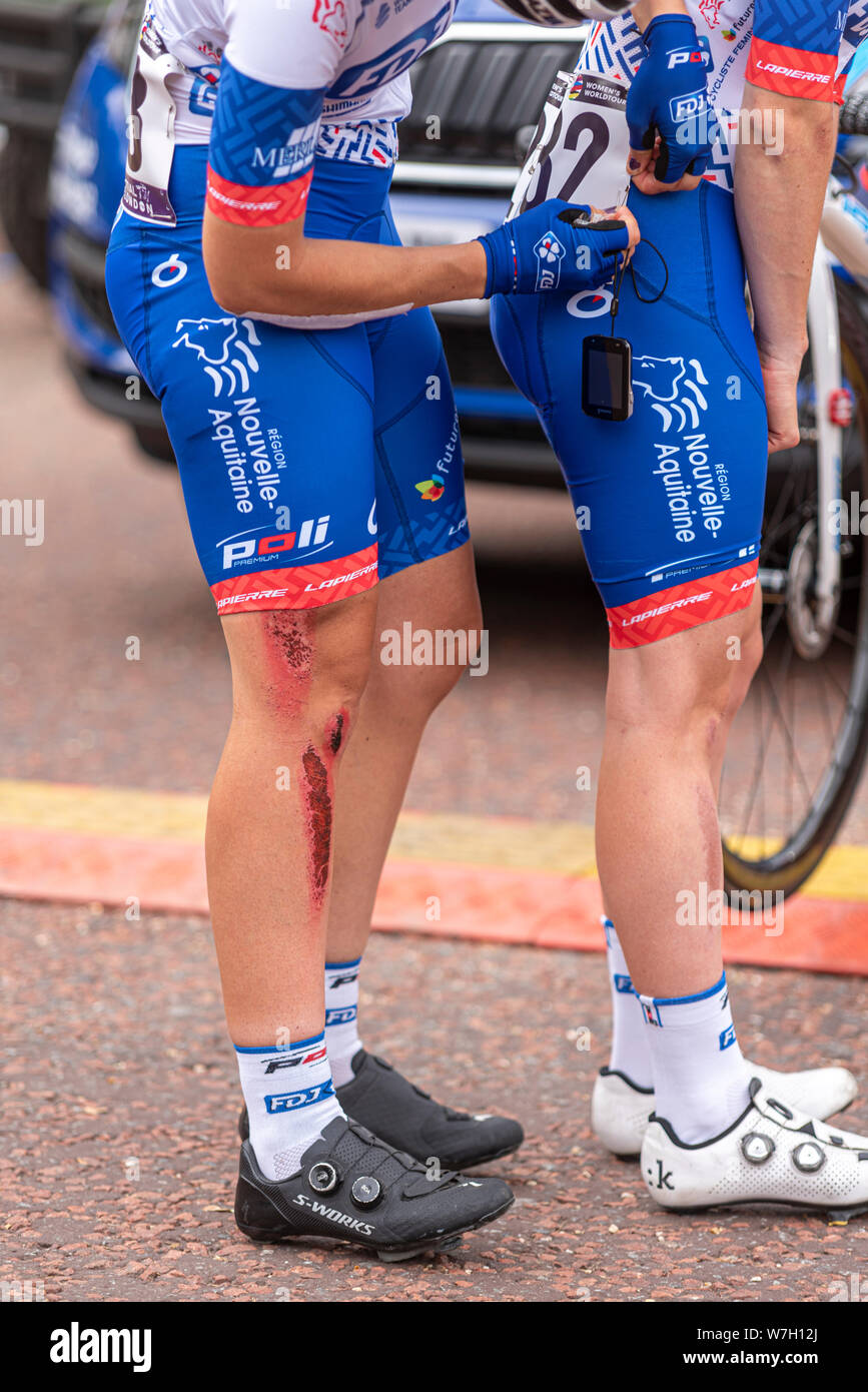 Road rash hi-res stock photography and images - Alamy
