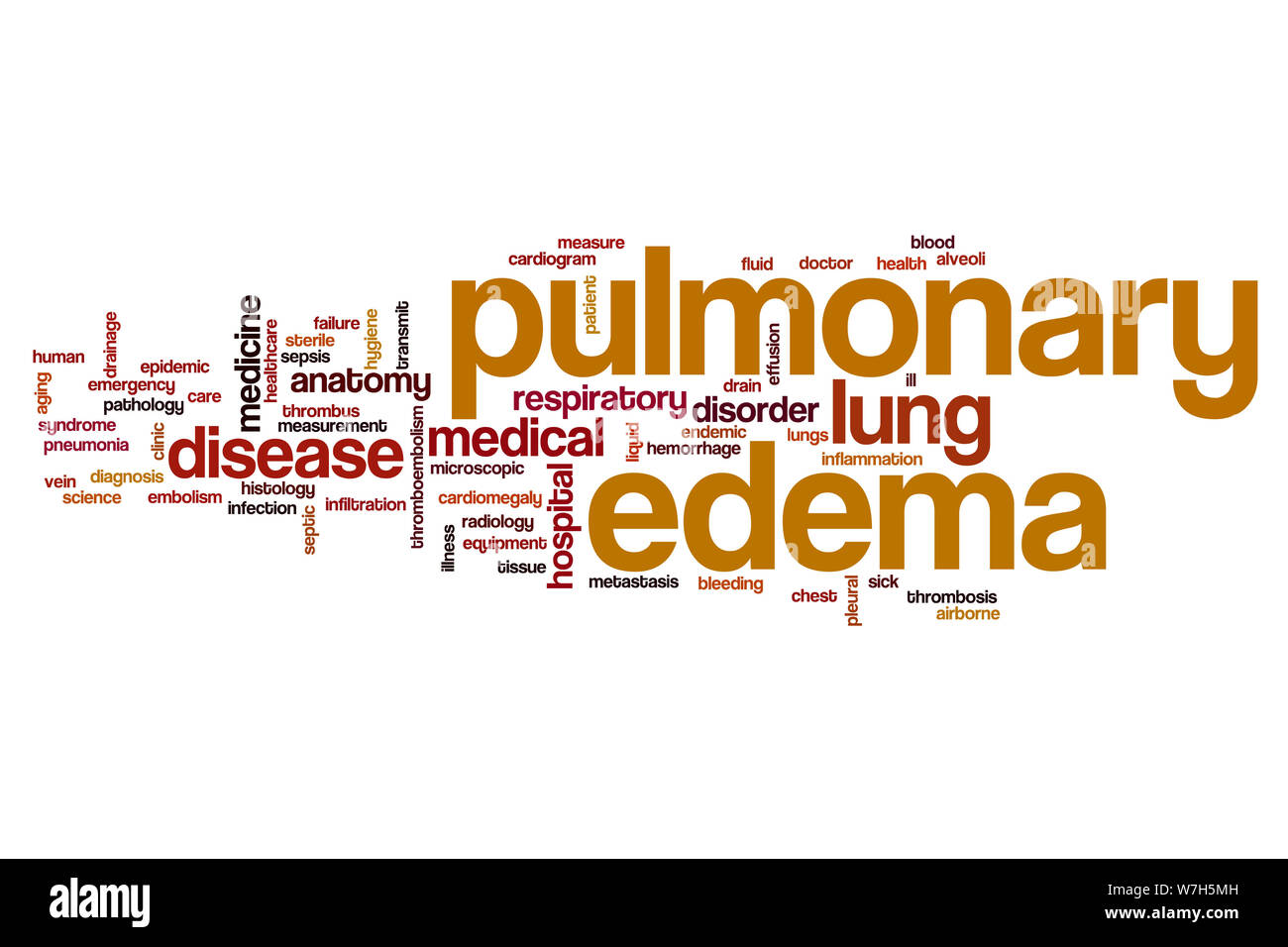 Pulmonary edema word cloud concept Stock Photo