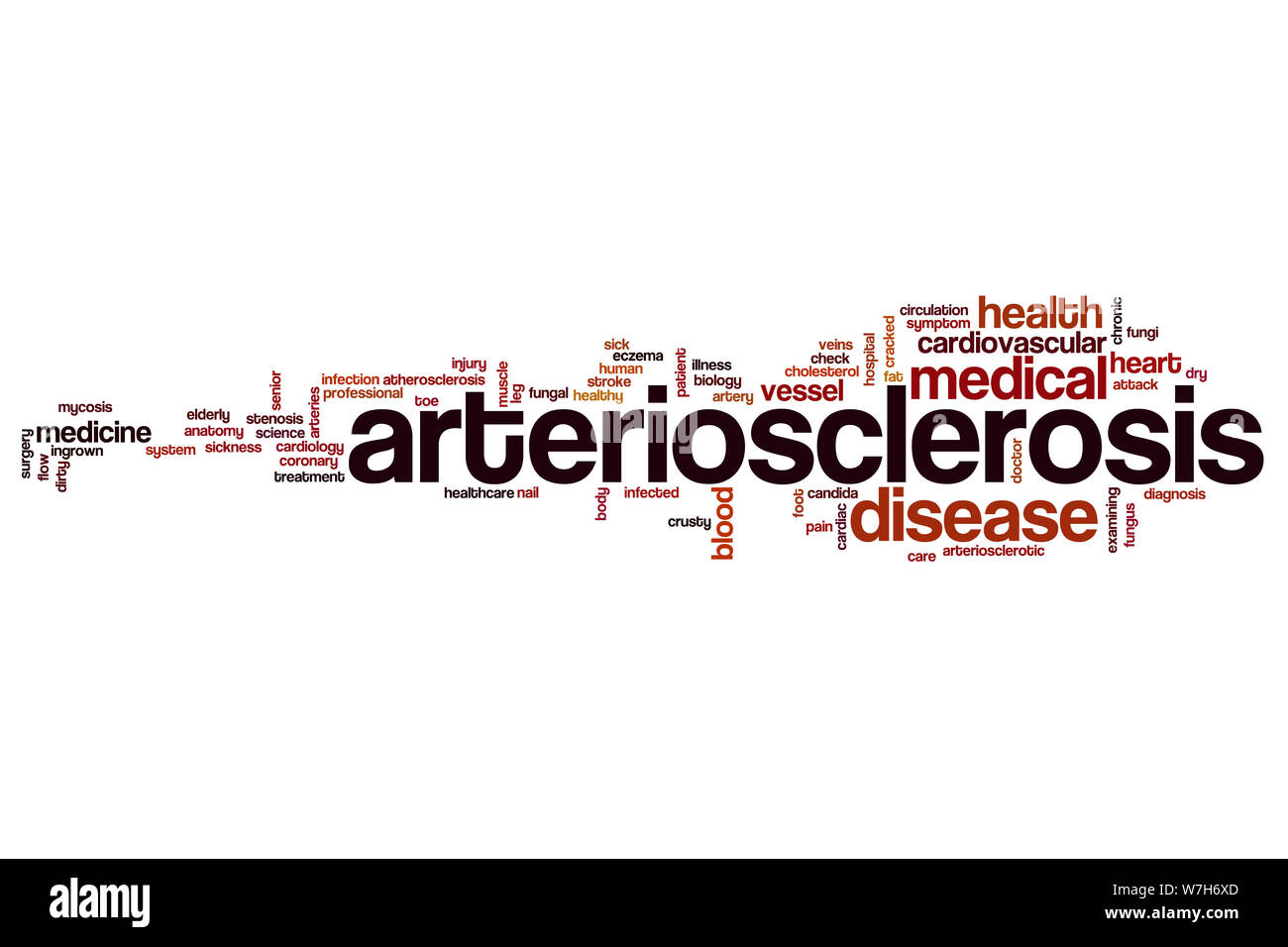 Arteriosclerosis word cloud concept Stock Photo