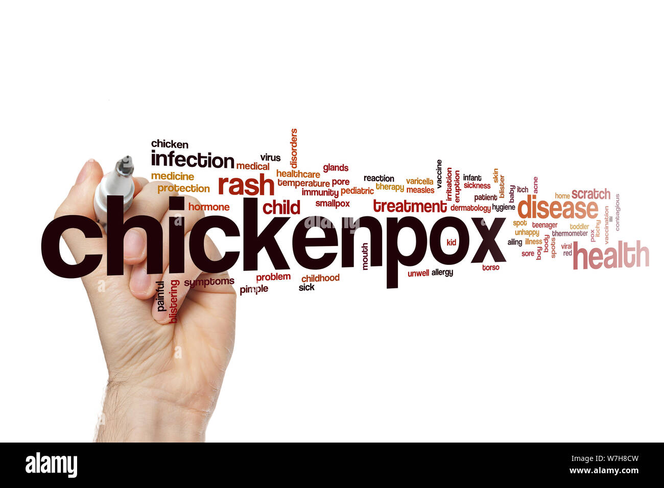 Chicken pox Cut Out Stock Images & Pictures Alamy