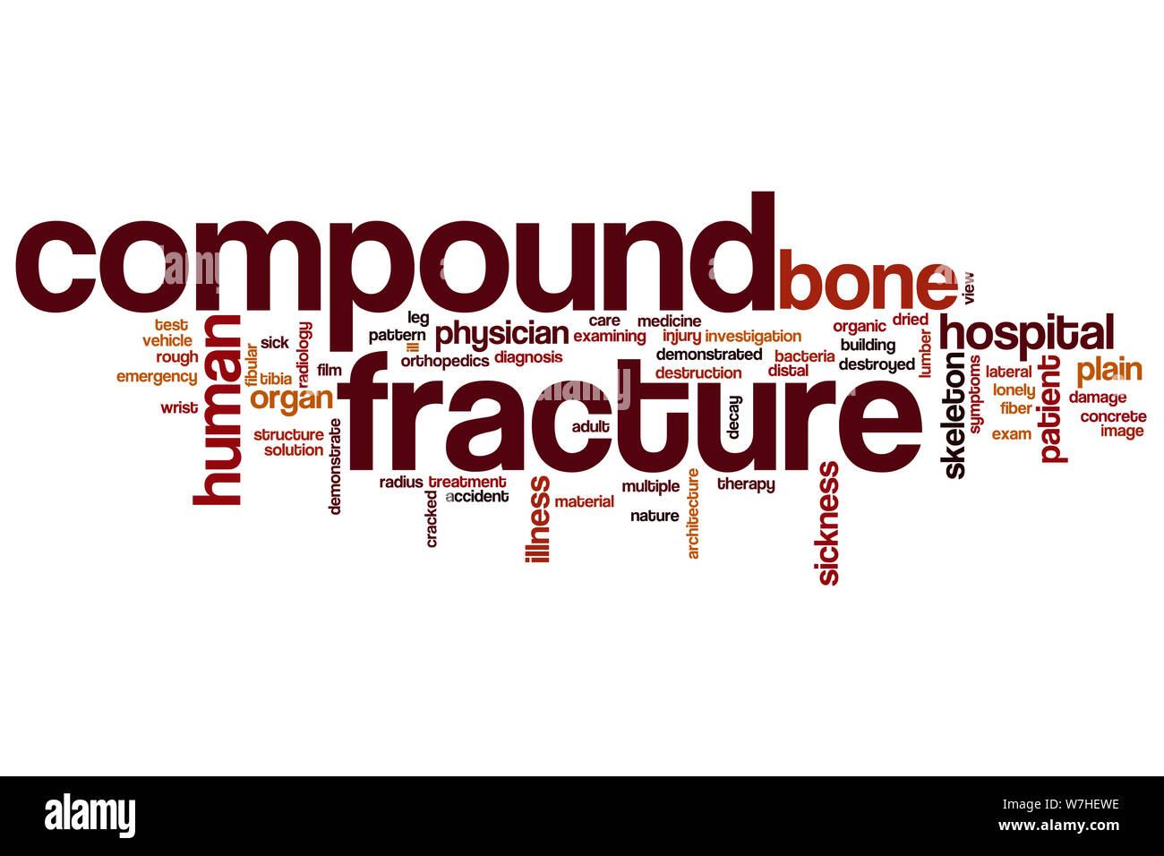 Compound fracture word cloud concept Stock Photo