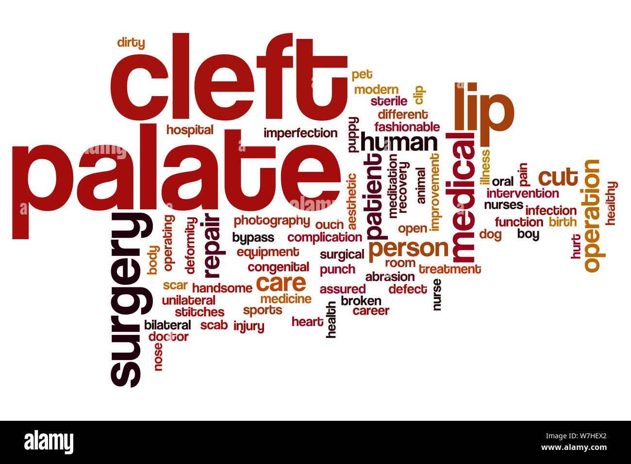 Cleft palate word cloud concept Stock Photo