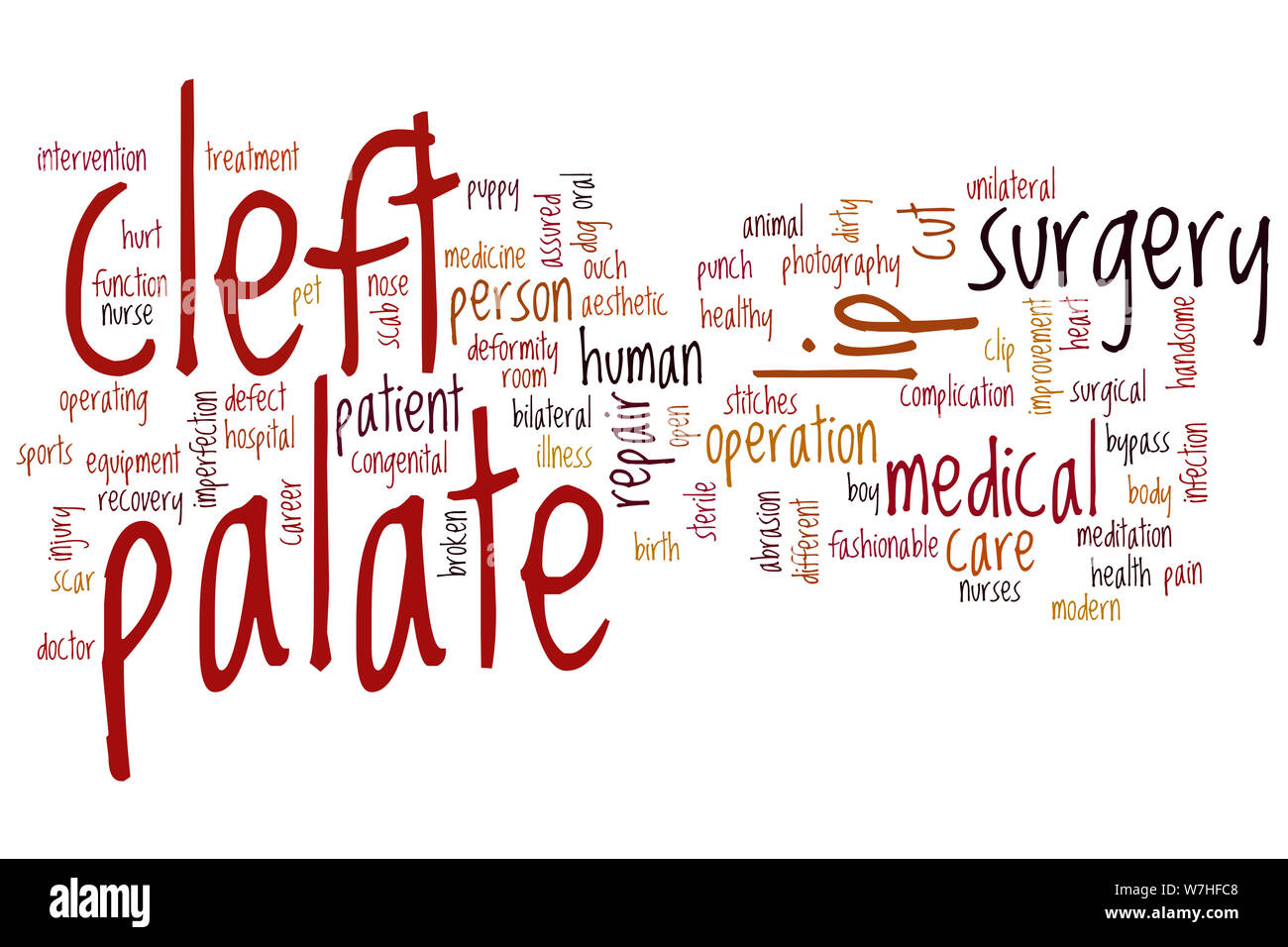 Cleft palate word cloud concept Stock Photo