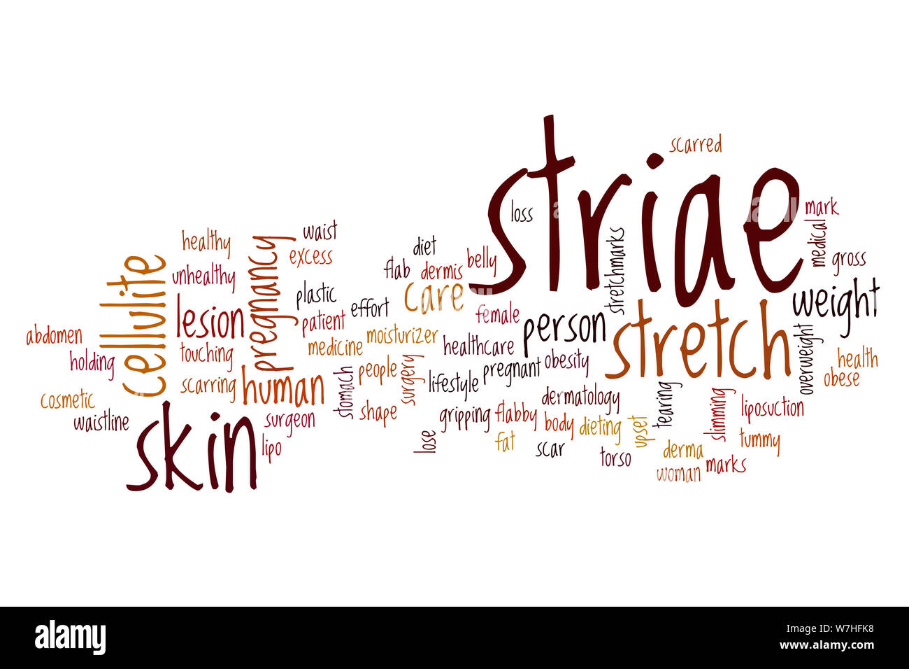 Striae word cloud concept Stock Photo