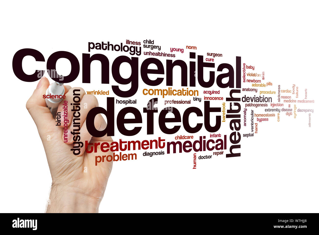 Congenital birth defect hi-res stock photography and images - Alamy