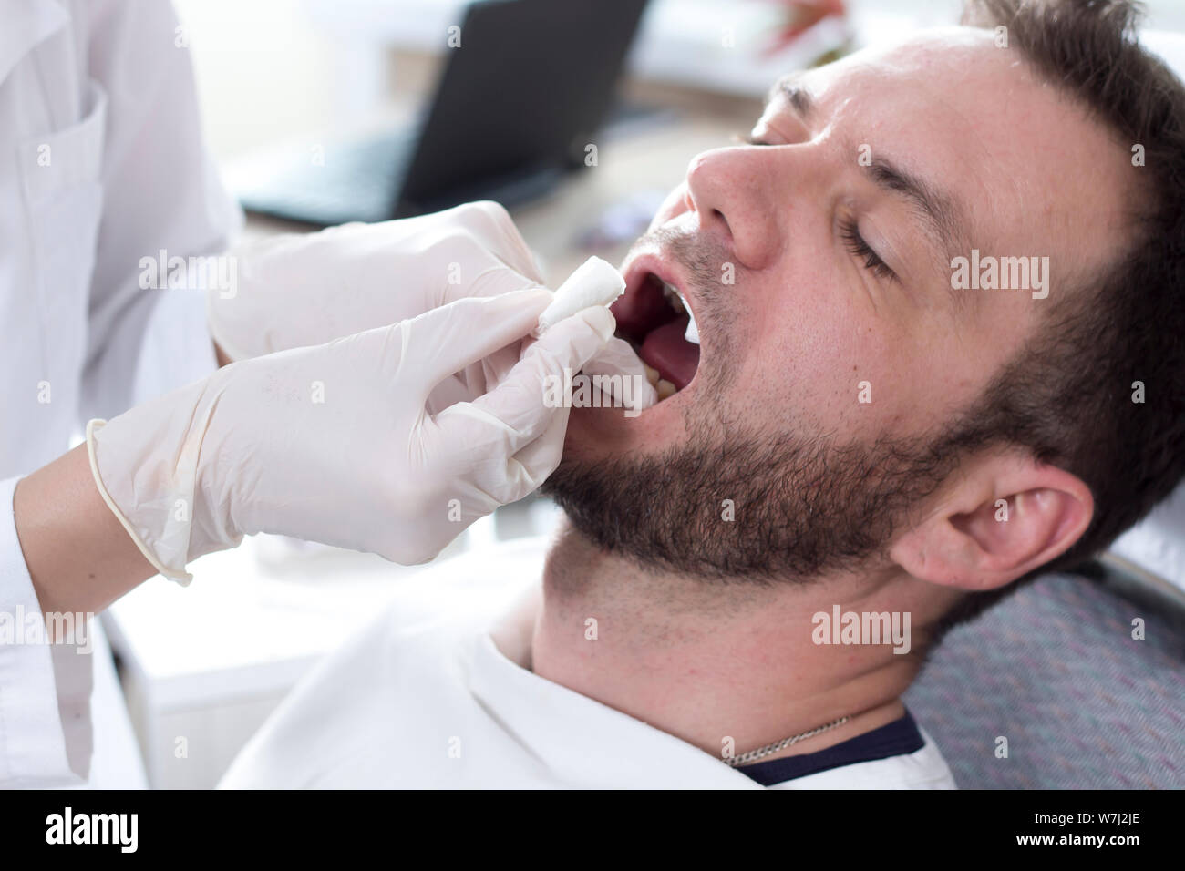 face of a white man with an open mouth on a dental chair. The doctor's hands in white gloves change the lignin roller in the patient's mouth. Stock Photo