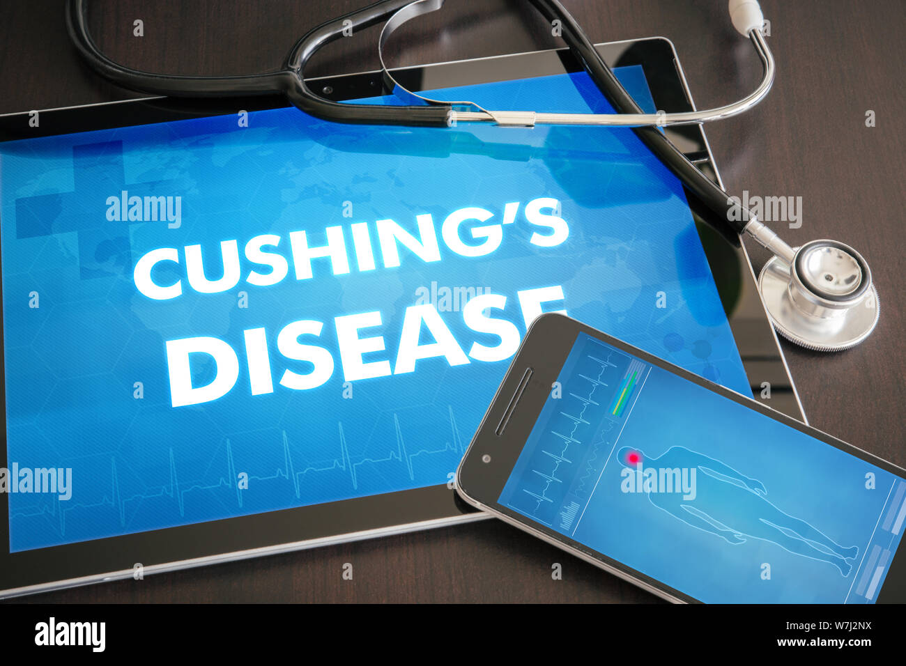Cushing's disease (endocrine disease) diagnosis medical concept on