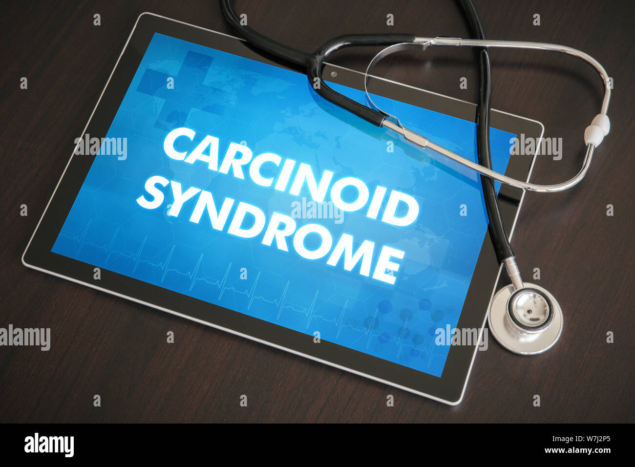 Carcinoid syndrome (endocrine disease) diagnosis medical concept on tablet screen with stethoscope. Stock Photo