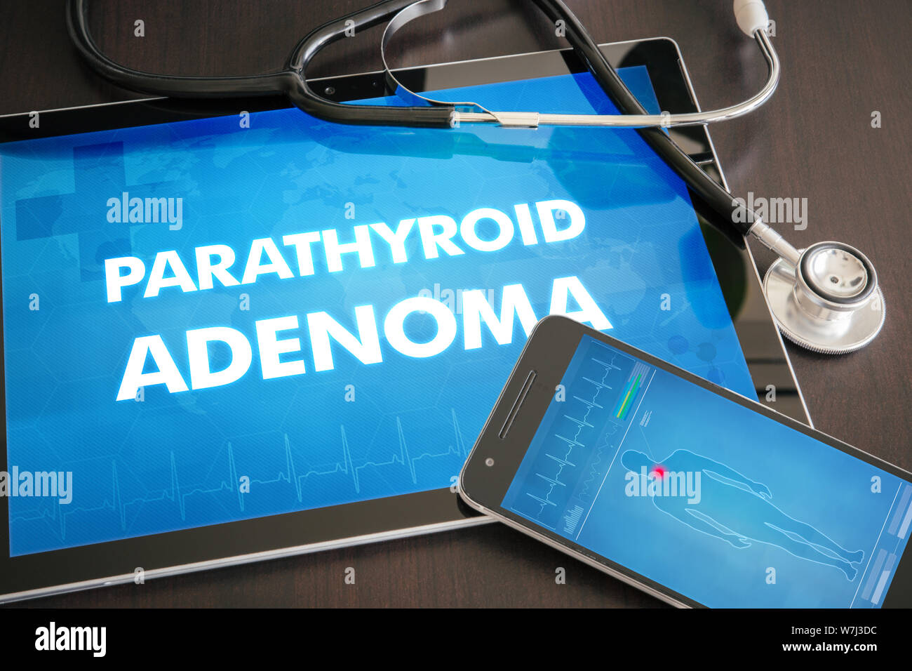 Parathyroid adenoma (endocrine disease) diagnosis medical concept on tablet screen with stethoscope. Stock Photo