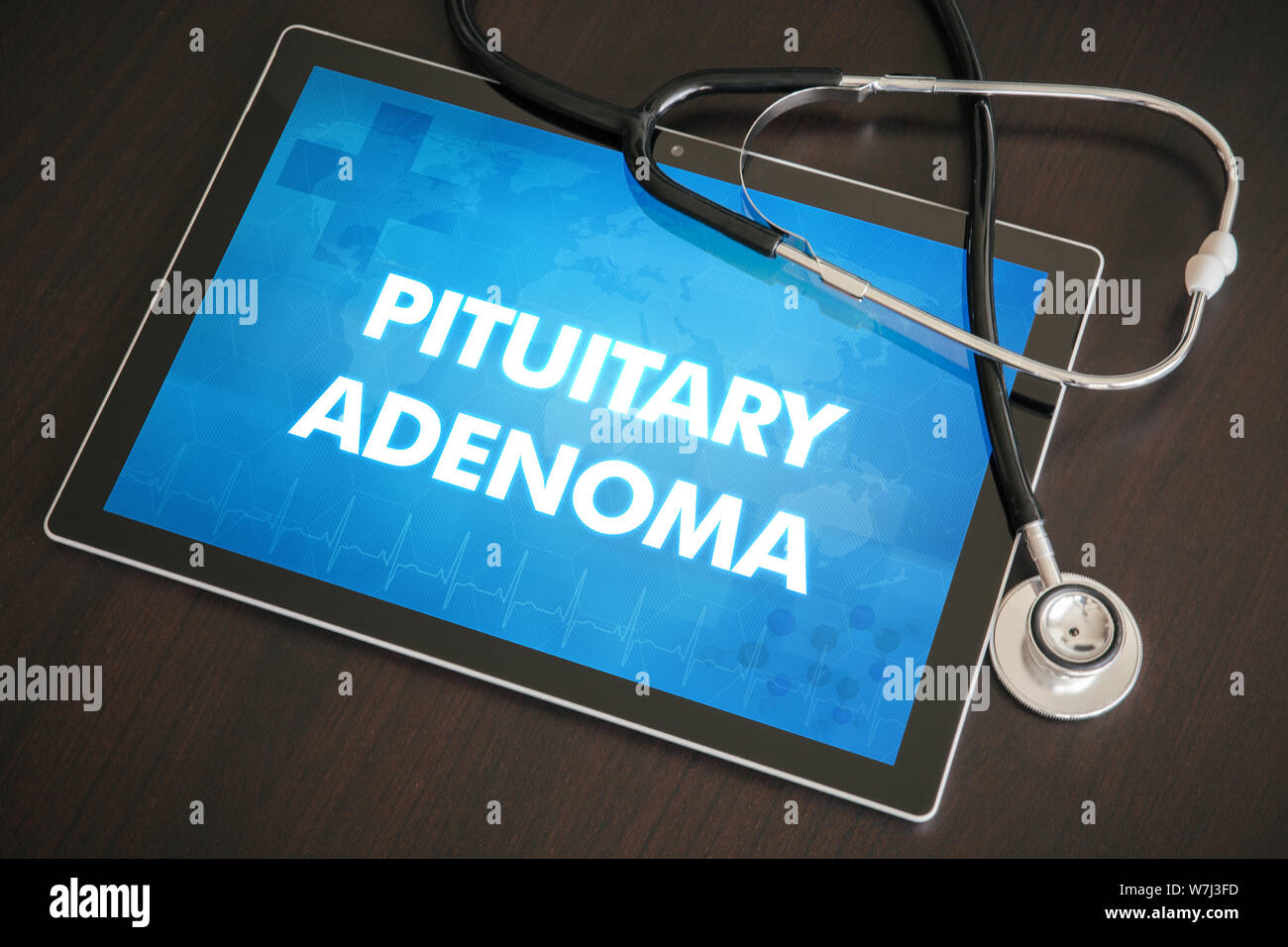 Pituitary adenoma (endocrine disease) diagnosis medical concept on tablet screen with stethoscope. Stock Photo