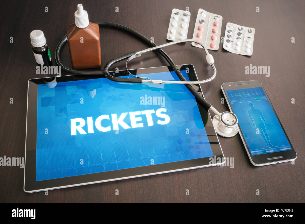 Rickets (endocrine disease) diagnosis medical concept on tablet screen with stethoscope. Stock Photo
