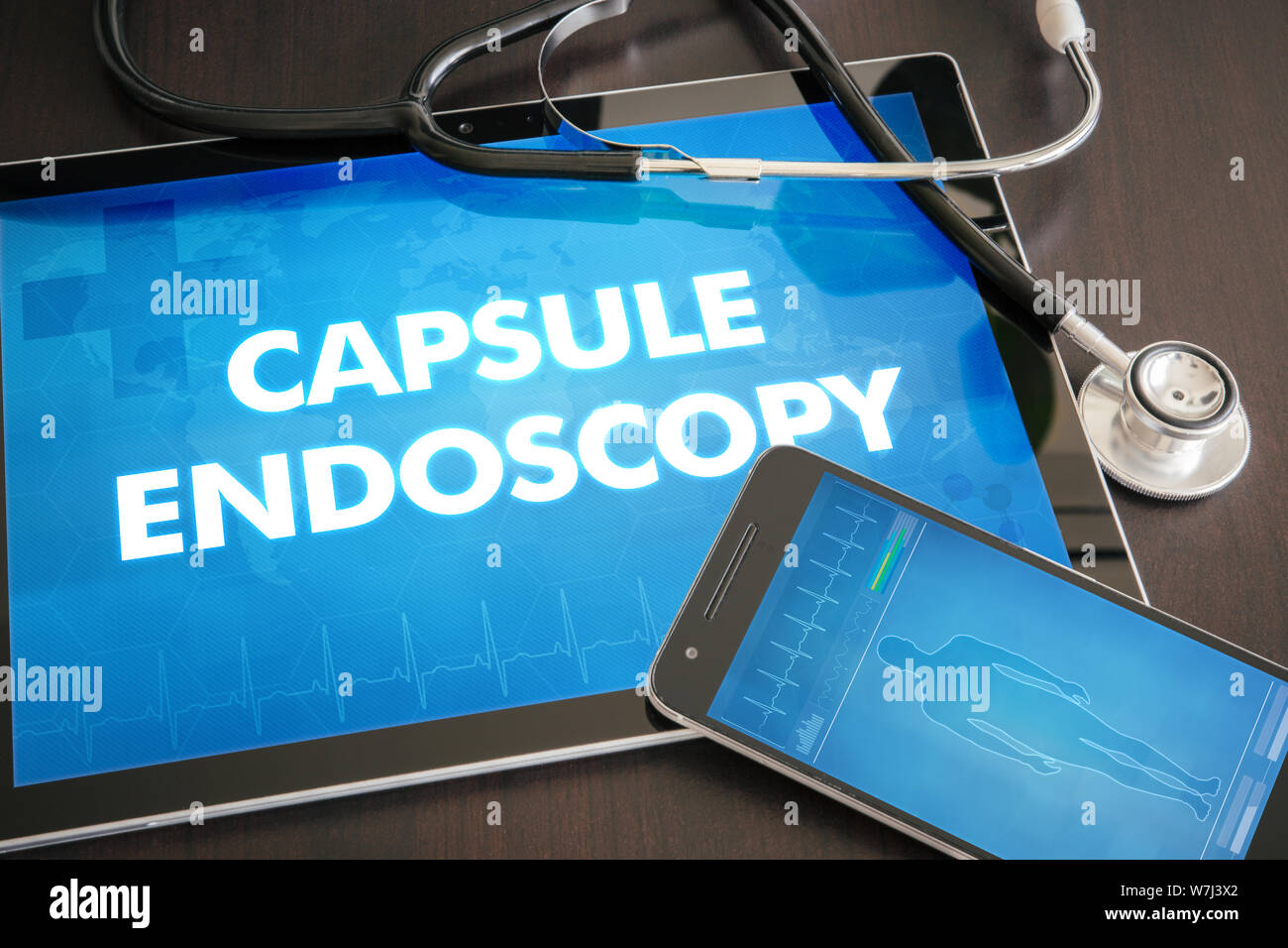 Capsule endoscopy (gastrointestinal disease related) diagnosis medical concept on tablet screen with stethoscope. Stock Photo