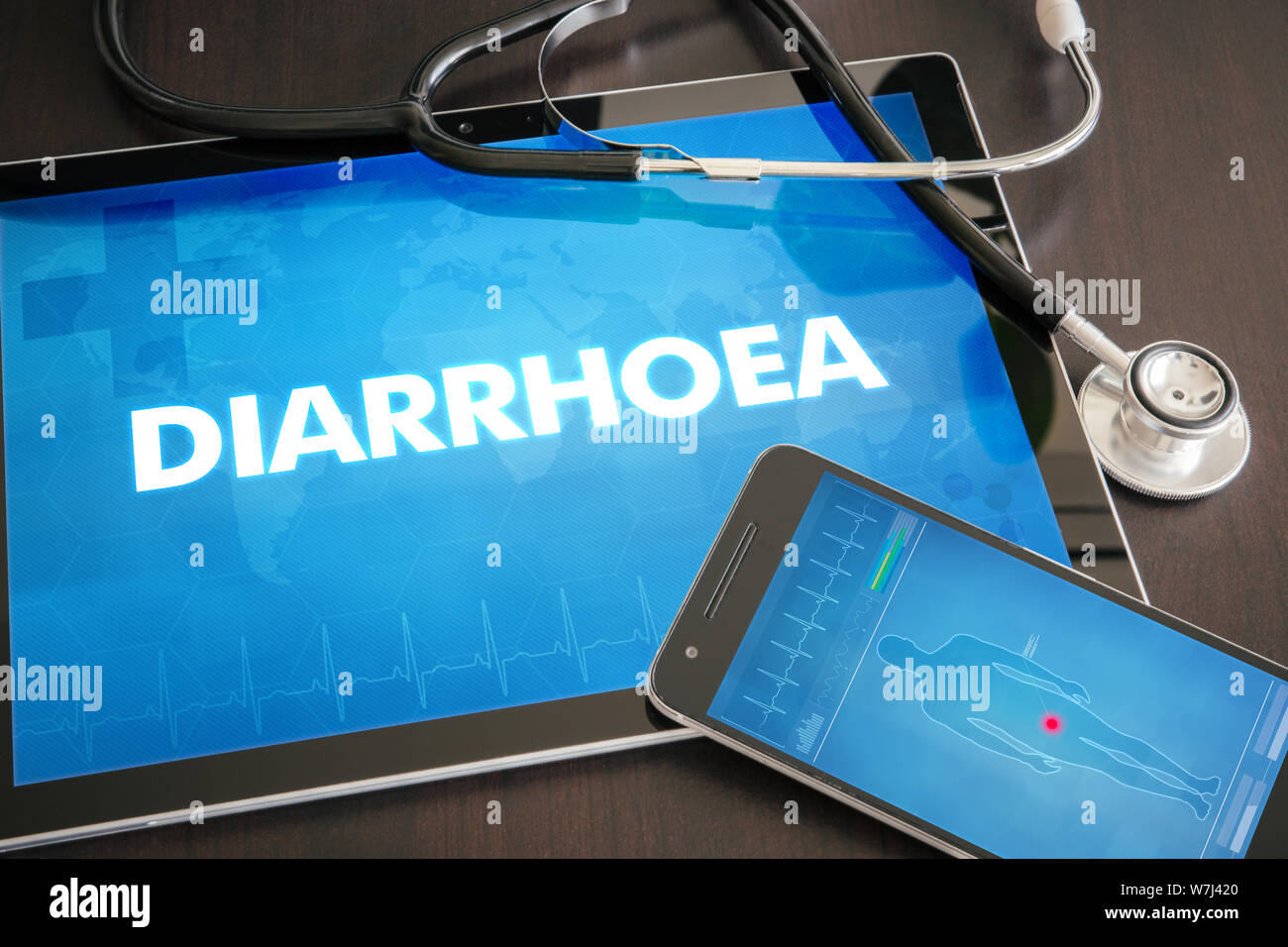 Diarrhoea (gastrointestinal disease related) diagnosis medical concept on tablet screen with stethoscope. Stock Photo