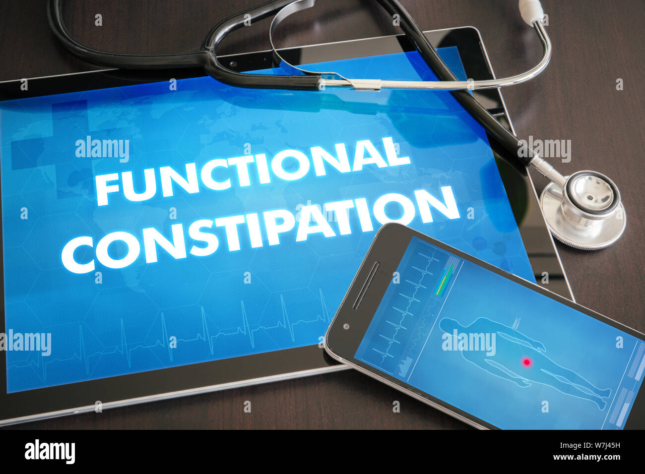 Functional constipation (gastrointestinal disease related) diagnosis medical concept on tablet screen with stethoscope. Stock Photo