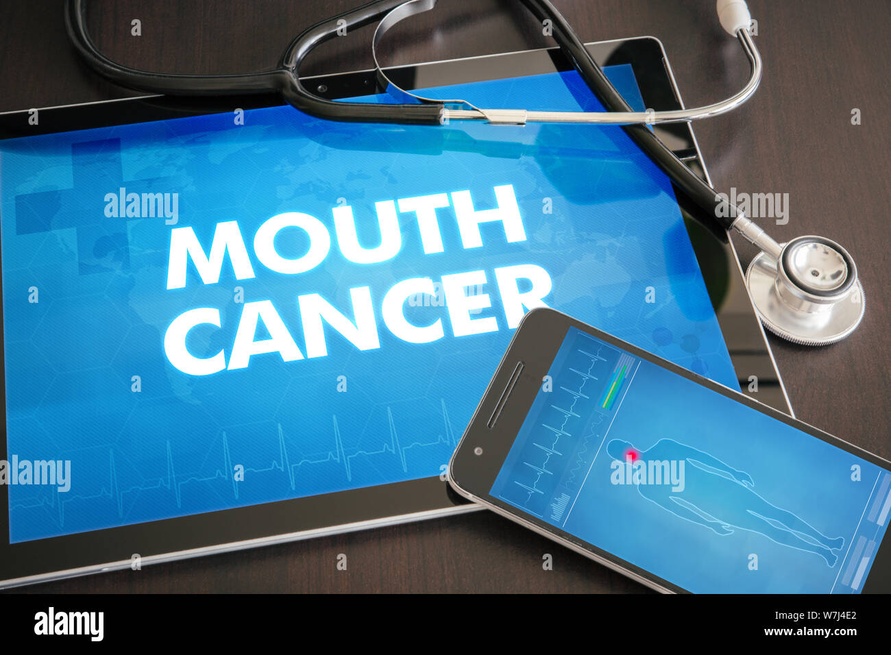 Mouth cancer (cancer type) diagnosis medical concept on tablet screen with stethoscope. Stock Photo