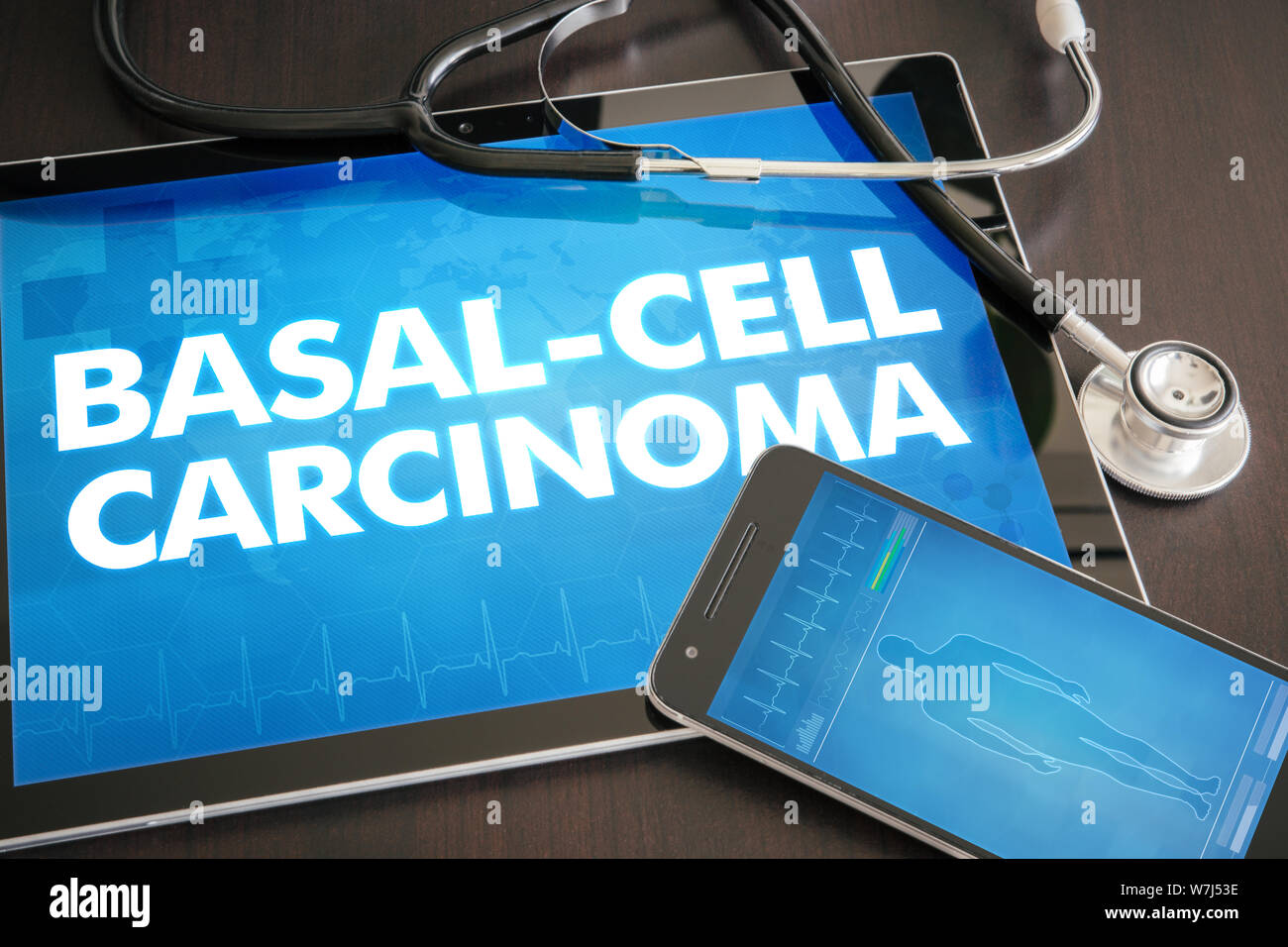Basal-cell carcinoma (cancer type) diagnosis medical concept on tablet screen with stethoscope. Stock Photo