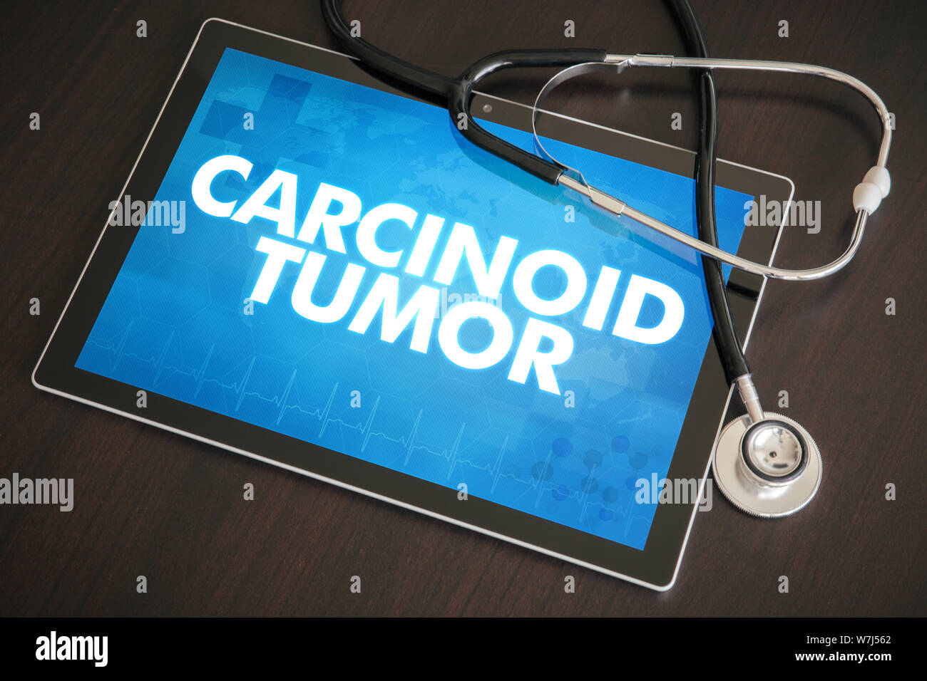 Carcinoid tumor (cancer related) diagnosis medical concept on tablet screen with stethoscope. Stock Photo