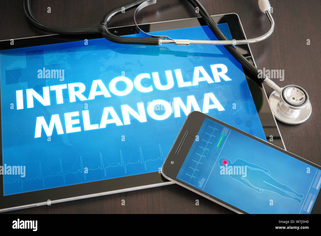 Intraocular melanoma (cancer type) diagnosis medical concept on tablet screen with stethoscope. Stock Photo