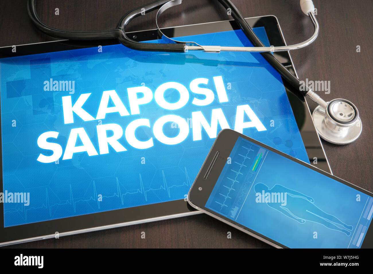 Kaposi sarcoma (cancer type) diagnosis medical concept on tablet screen with stethoscope. Stock Photo
