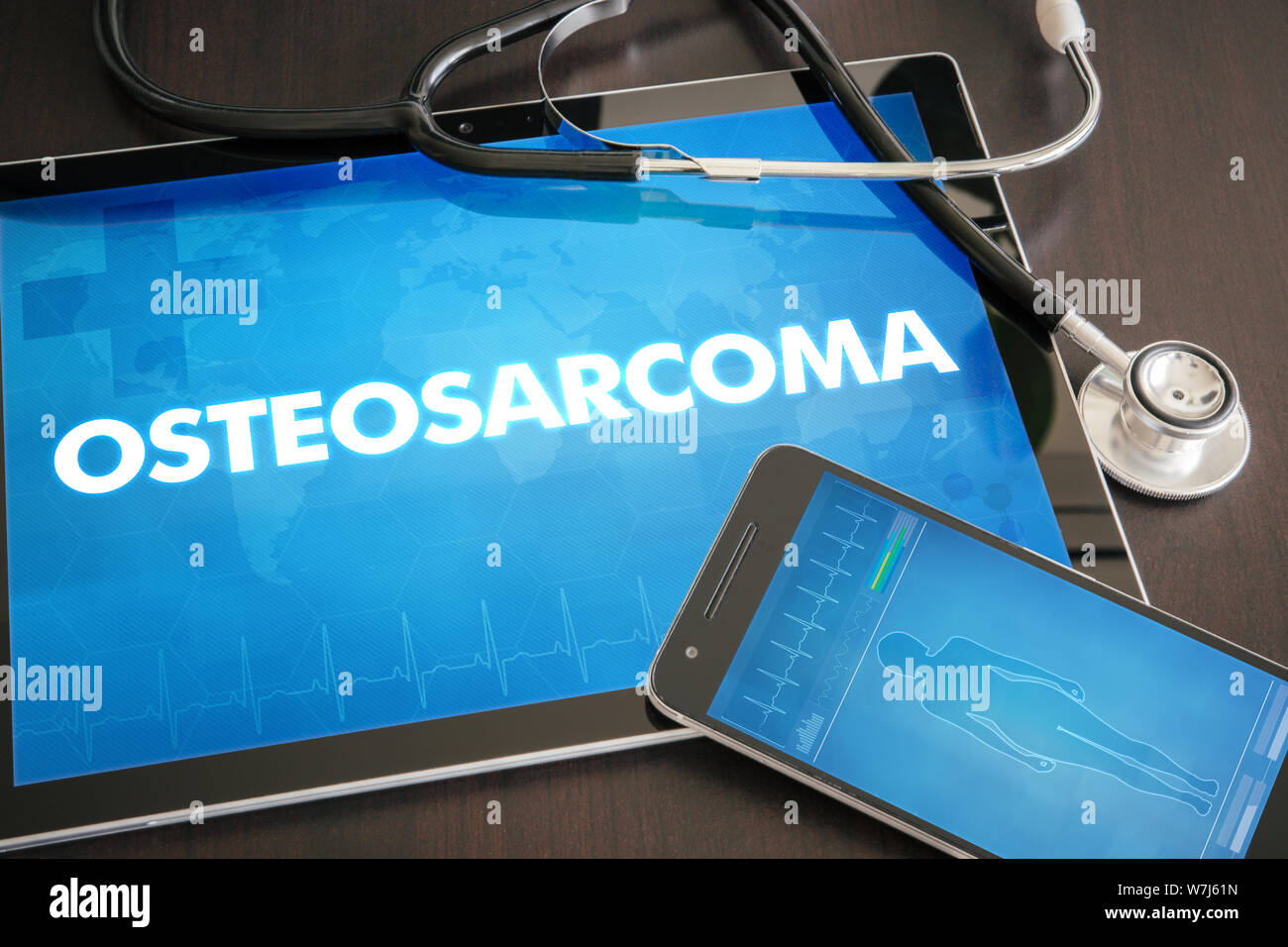 Osteosarcoma (cancer type) diagnosis medical concept on tablet screen with stethoscope. Stock Photo
