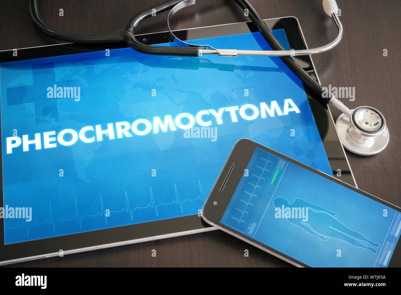 Pheochromocytoma (cancer type) diagnosis medical concept on tablet screen with stethoscope. Stock Photo