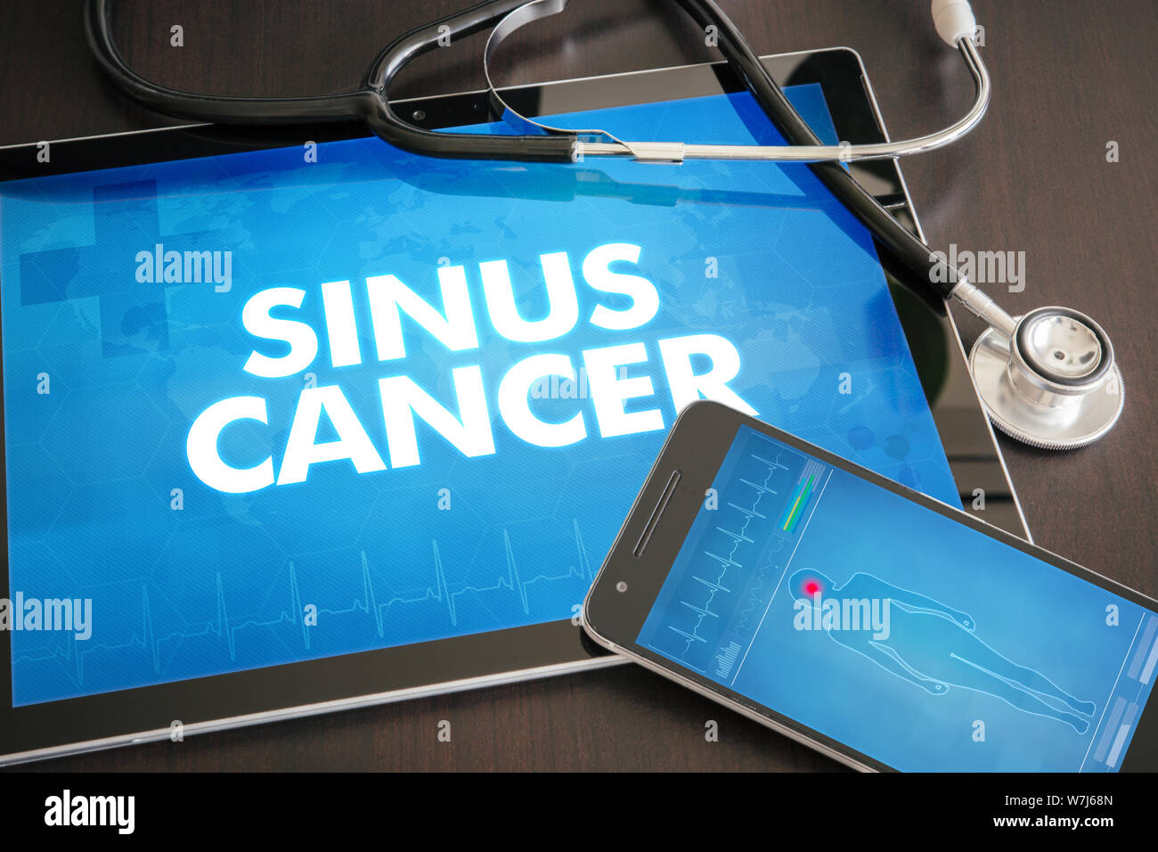 Sinus cancer (cancer type) diagnosis medical concept on tablet screen with stethoscope. Stock Photo