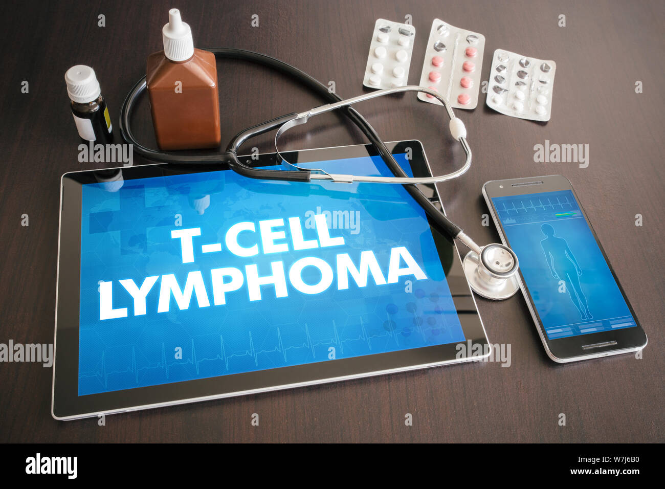 T-cell lymphoma (cancer type) diagnosis medical concept on tablet screen with stethoscope. Stock Photo
