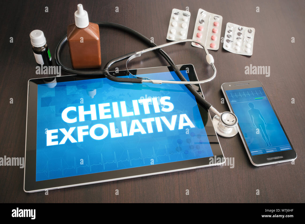 Cheilitis exfoliativa (cutaneous disease) diagnosis medical concept on tablet screen with stethoscope. Stock Photo