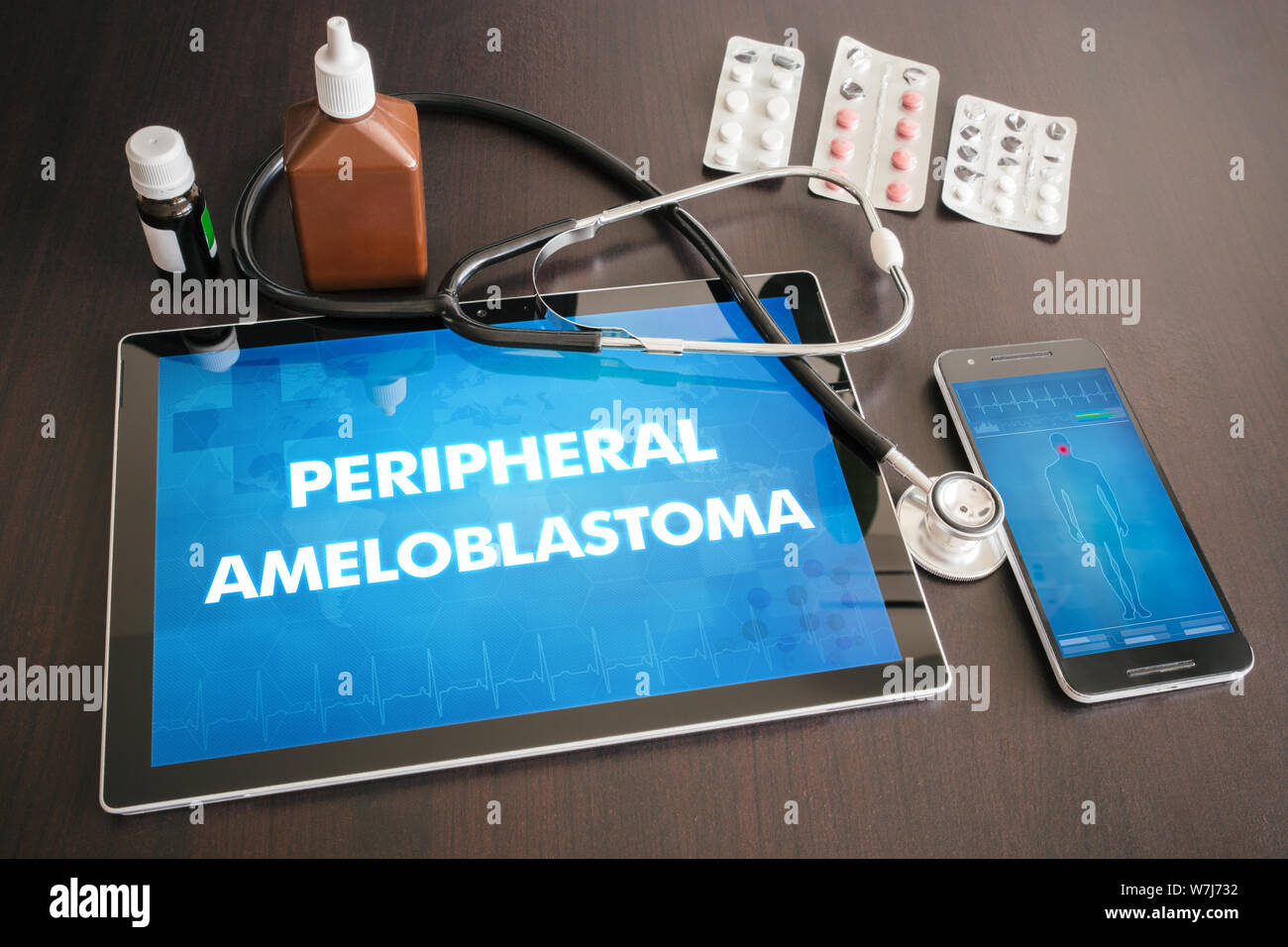 Peripheral ameloblastoma (cutaneous disease) diagnosis medical concept