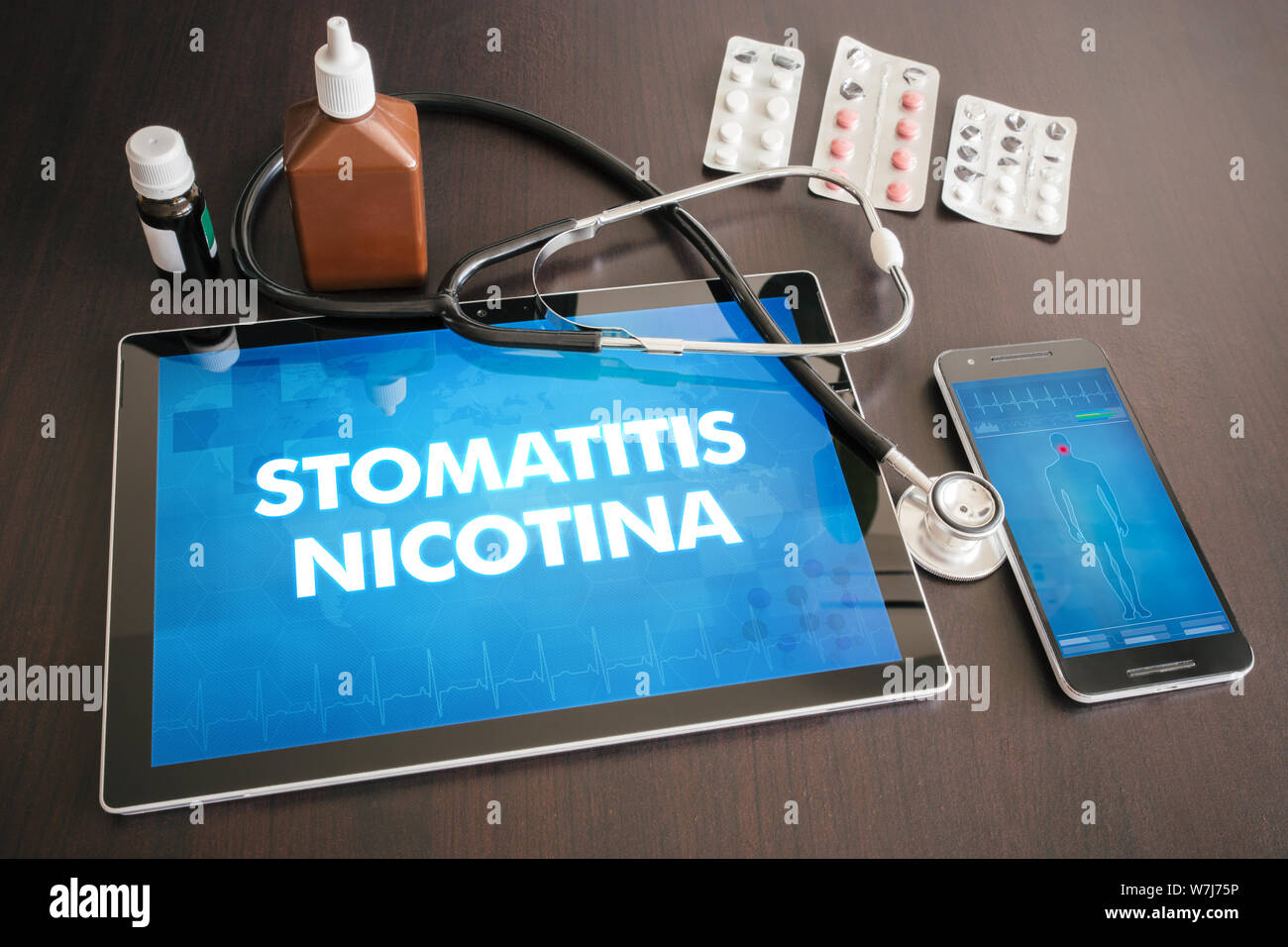 Stomatitis nicotina (cutaneous disease) diagnosis medical concept on tablet screen with stethoscope. Stock Photo