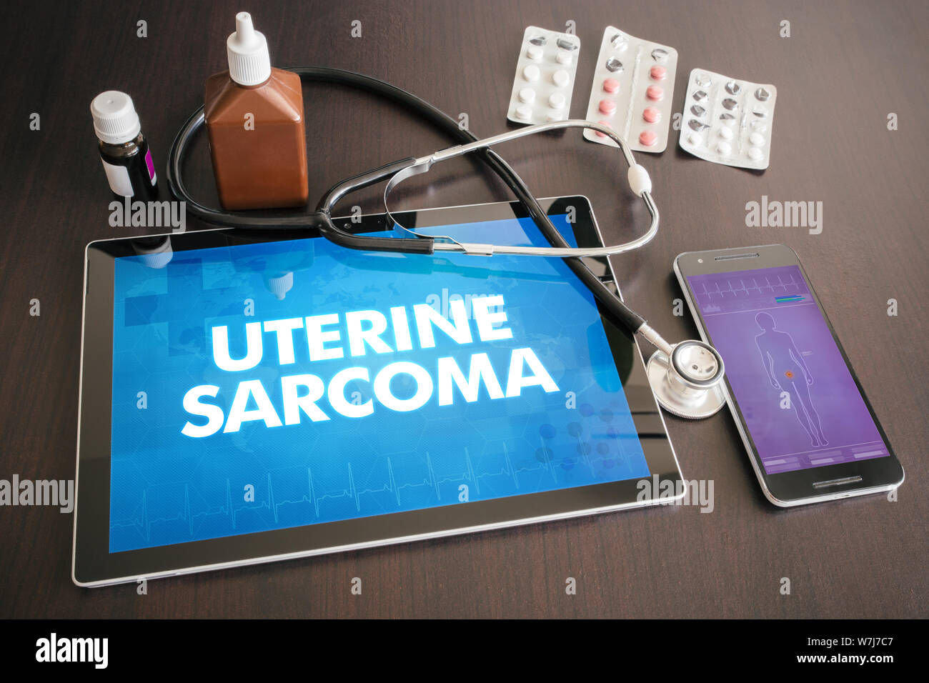 Uterine sarcoma (cancer type) diagnosis medical concept on tablet screen with stethoscope. Stock Photo