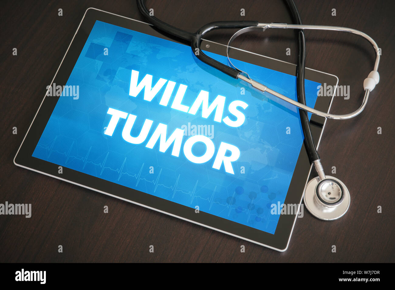 Wilms tumor (cancer type) diagnosis medical concept on tablet screen with stethoscope. Stock Photo