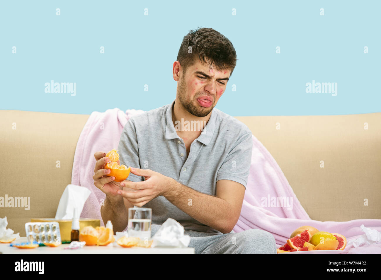 Young man suffering from allergy to citrus fruits. Having skin rash