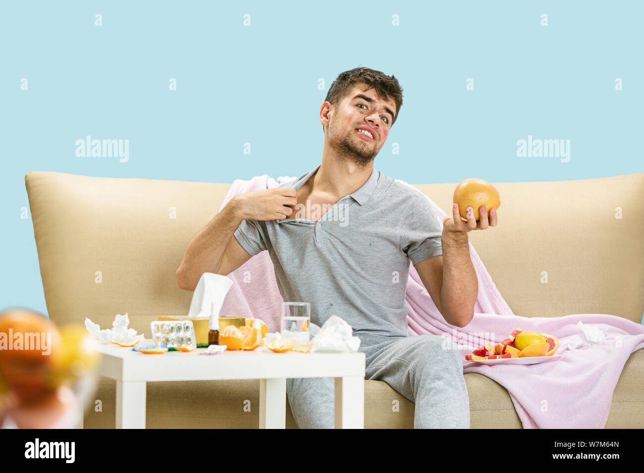 Young man suffering from allergy to citrus fruits. Having skin rash